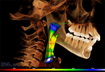 3D Orthodontics