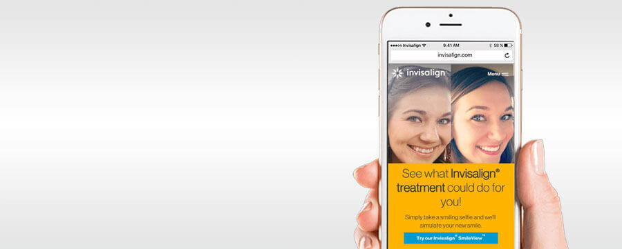 Invisalign SmileView